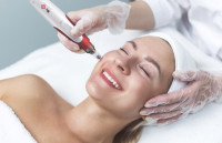 /album/microneedling/img-7790-jpeg/